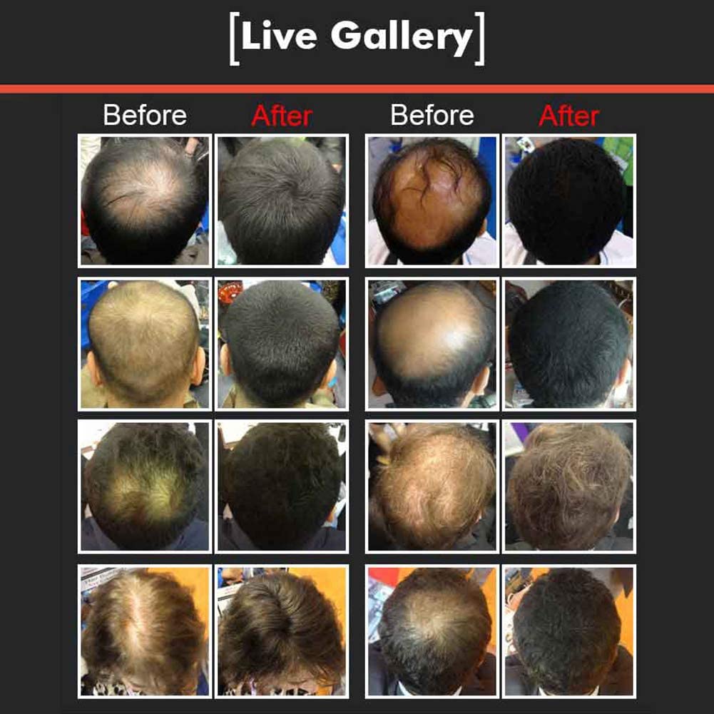 Fibers de renforcement des cheveux pour femmes et hommes